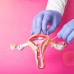 Tubal Ligation Reversal