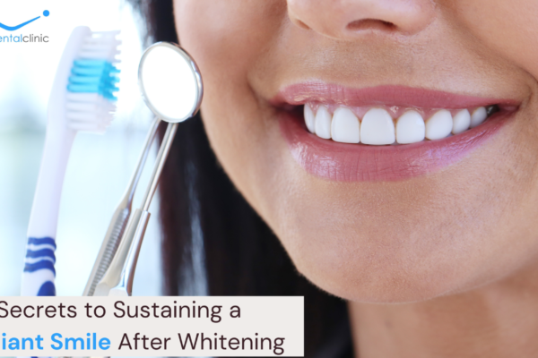 Whitening