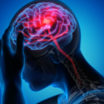 Are Structured Settlements Beneficial For Brain Injury Cases?