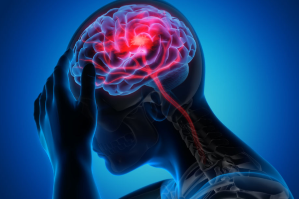 Are Structured Settlements Beneficial For Brain Injury Cases?