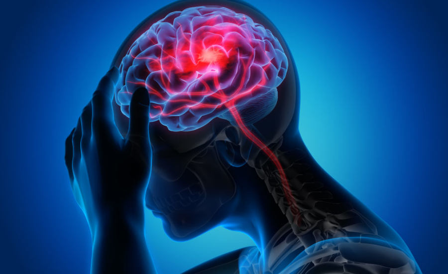 Are Structured Settlements Beneficial For Brain Injury Cases?