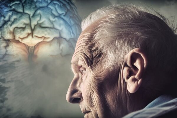 Alzheimer's Disease