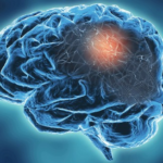 Doctorhub360.com Neurological Diseases